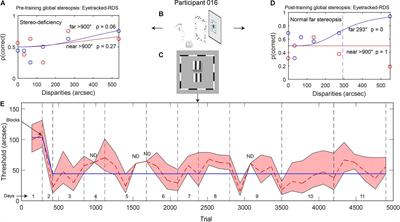 Transfer of Perceptual Learning From Local Stereopsis to Global Stereopsis in Adults With Amblyopia: A Preliminary Study